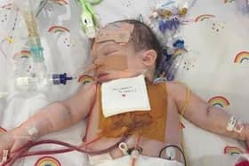 Harry Shrubb underwent heart surgery at eight days old