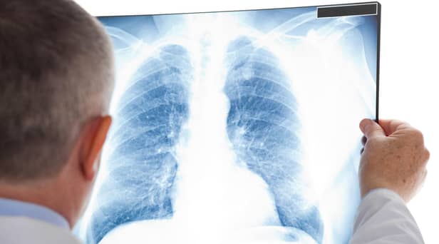 The initiative has not only diagnosed early stages of cancer but respiratory and cardiovascular disease too.