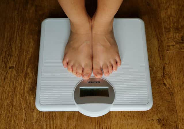 Of those children who were obese,  6.7 per cent were severely obese, with a body mass index (BMI) in the top 0.4 per cent for a child's age and sex.
