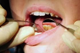 NHS Digital figures show around 535 admissions for children who needed teeth removed in the former NHS Wigan Borough CCG area — up on 380 the year before