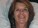 Linda Davis, 71, was in Southwell Road East, Rainworth, when she was hit by a privately-owned electric scooter.