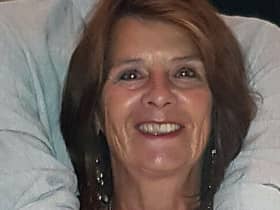 Linda Davis, 71, was in Southwell Road East, Rainworth, when she was hit by a privately-owned electric scooter.