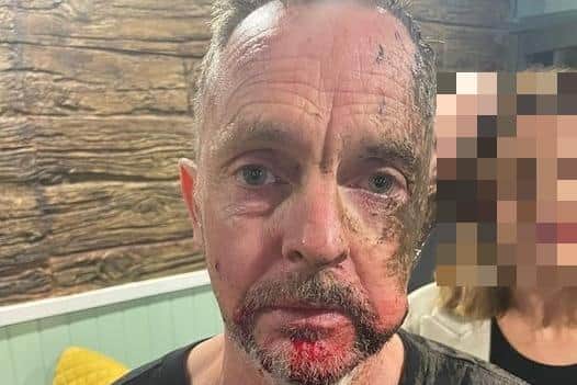 A 'have-a-go hero' was assaulted after he challenged yobs during Halloween night