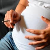 NHS Digital figures show there were 64 pregnant women who were known to be smokers at the time of delivery in Wigan in the three months to September 2023