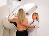 Breast screening