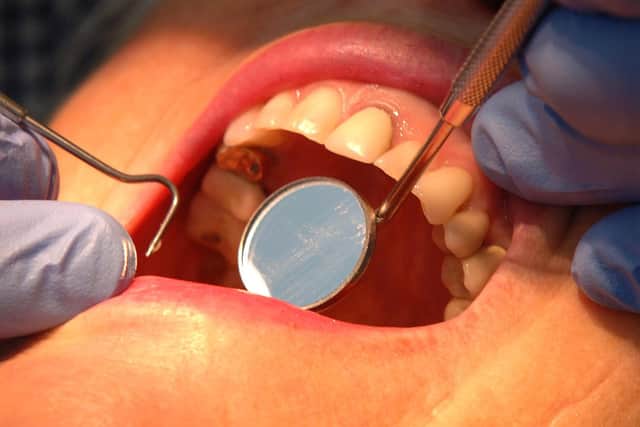Scores of Wigan youngsters had teeth removed during the first year of the pandemic