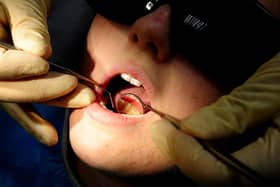 Figures from the Office for Health Improvement and Disparities show there were an estimated 675 total hospital admissions in Wigan for children's tooth extraction in the year to March 2023.Of these, about 545 were extractions for tooth decay.
