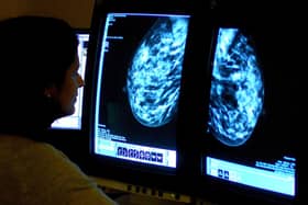 NHS England figures show 29,175 women aged between 53 and 71 in Wigan underwent a breast screening in the three years to March – up from 26,742 in the three years to March 2023
