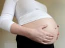 The number of Wigan pregnancies rose between 2019 and 2020