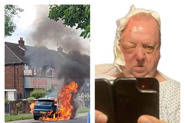 The blazing car which left Dave Butler (right) with serious burns