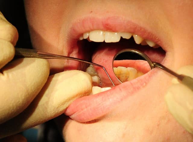 Some dentists' morale is said to be rock bottom