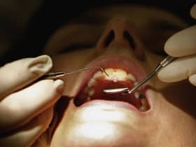 People are struggling to see NHS dentists