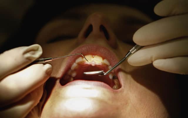 People are struggling to see NHS dentists