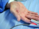 An emergency presentation is when a diagnosis is given within 30 days of a hospital admission and does not include more managed routes, such as cancer screening or through a GP.