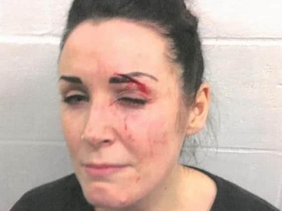 Alicia Crook following the unprovoked assault