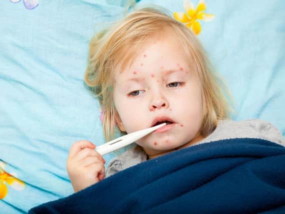 There has only been one case of measles in five years