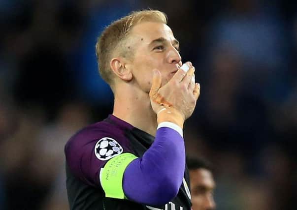 Joe Hart has been linked with a move to Chelsea