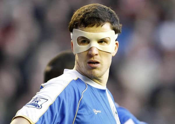 Gary Caldwell wore a protective mask playing against Liverpool