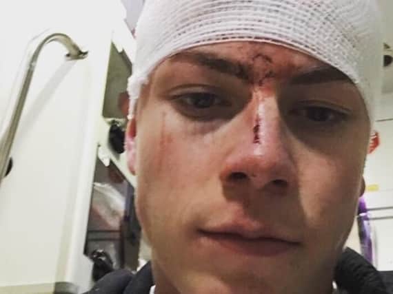 Wigan fan Josh Andrews who tweeted this picture of his bandaged head after a glass hit him